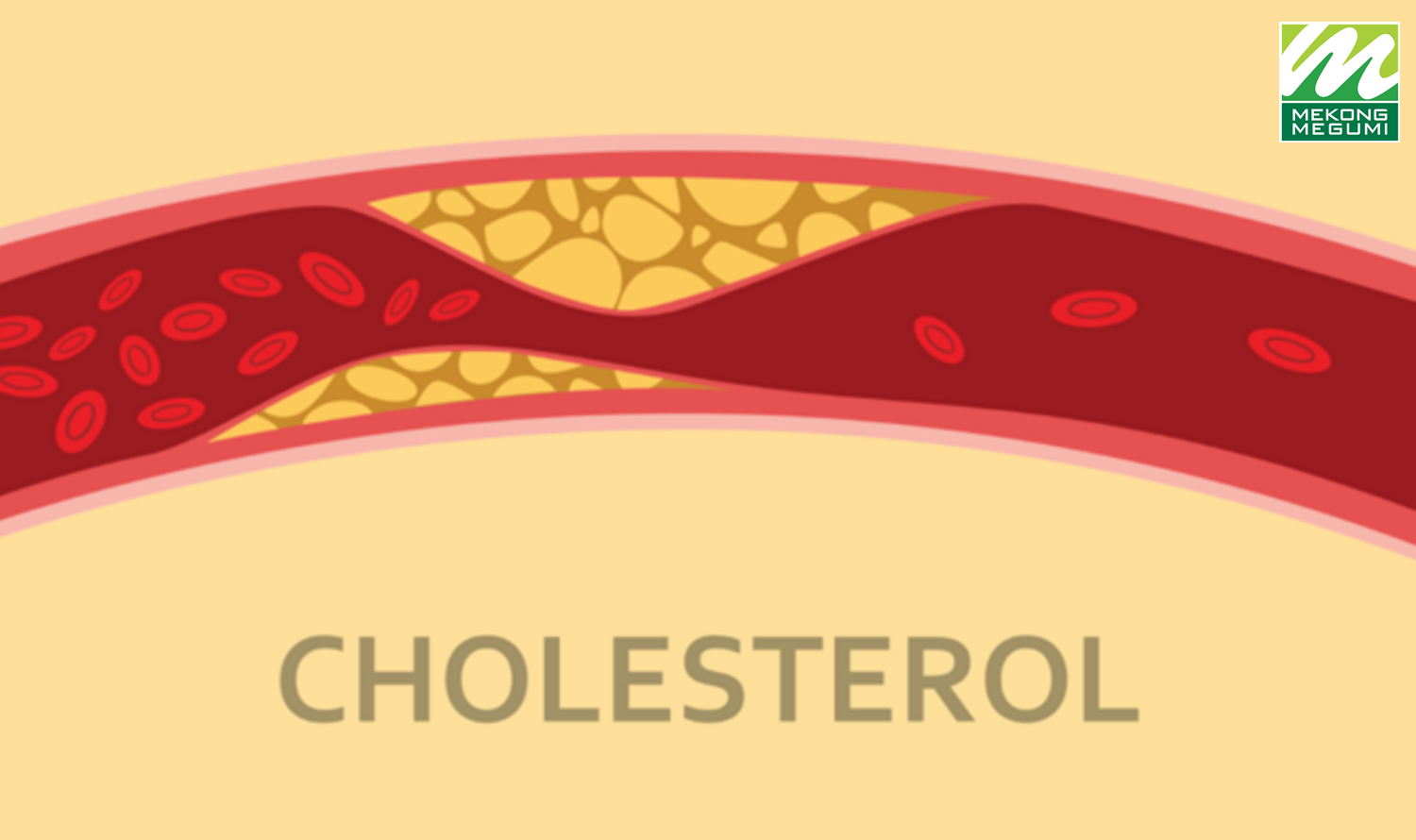 Cholesterol: bạn đã biết số của mình chưa?